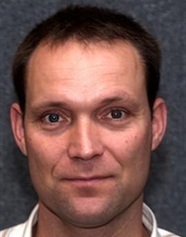 Eric Breker